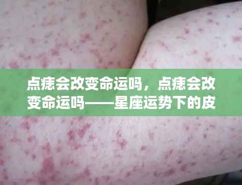 星座运势下的皮肤小手术,点痣能否改变命运?