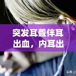 突发耳聋伴耳出血,内耳出血突聋